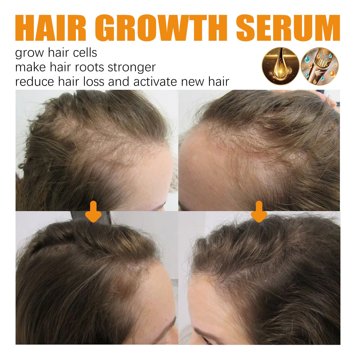 Biotin Hair Growth Spray – Scalp Massage Mist for Stronger, Fuller Hair