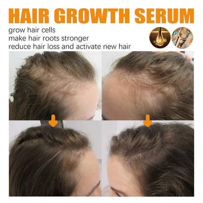 Biotin Hair Growth Spray – Scalp Massage Mist for Stronger, Fuller Hair